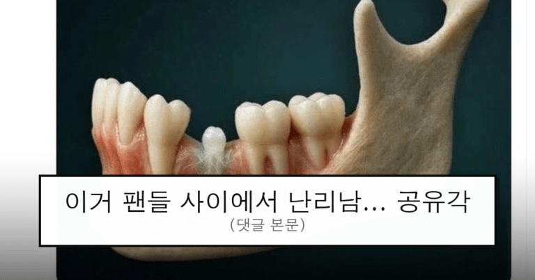 ruliweb_75629971_0_thumb