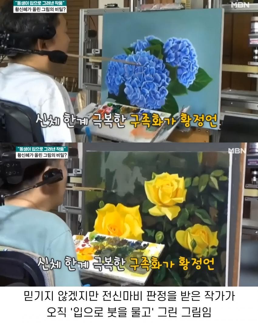 톱배우 누나를 둔 전신마비 동생의 직업 2번째 이미지