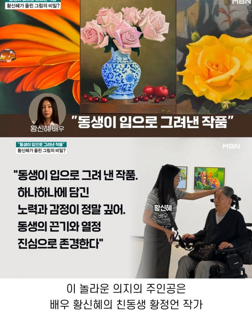 톱배우 누나를 둔 전신마비 동생의 직업 3번째 이미지